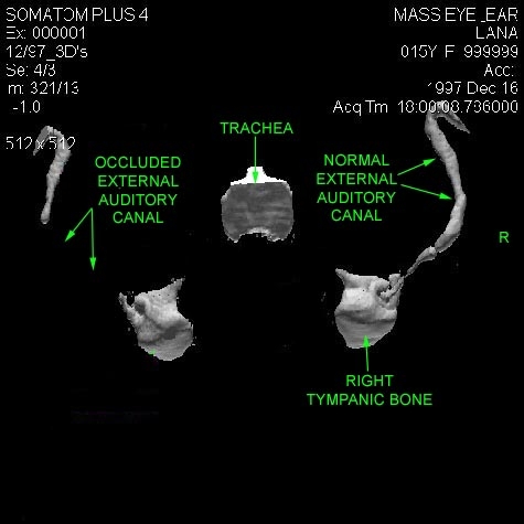 Auditory Pathology