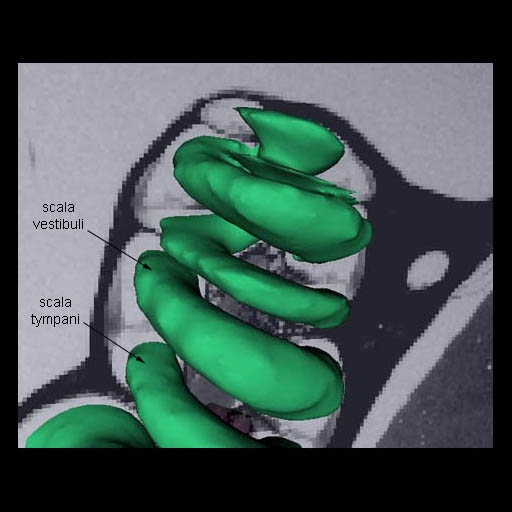 Chinchilla Cochlea