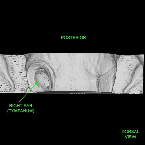 Congenital Defect