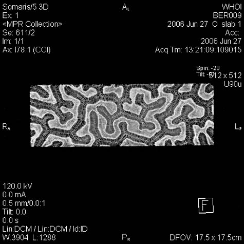 Brain Coral Section