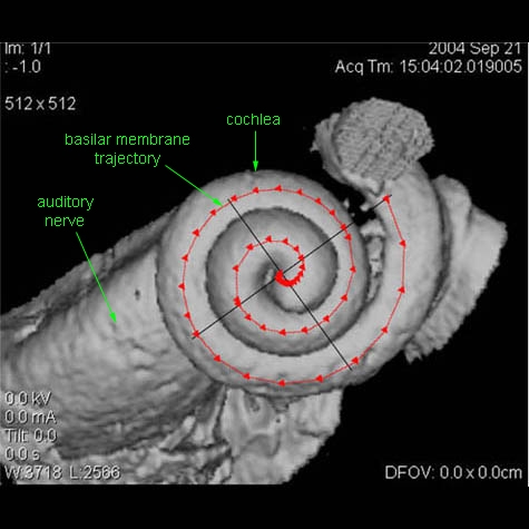 Human Cochlea