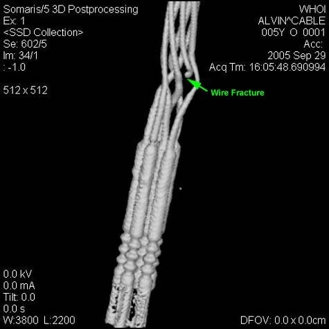 Cable from the ROV Atlantis