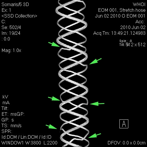 Stretch Hose Coil