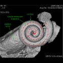 Human Cochlea