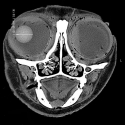 Ocular Malformation